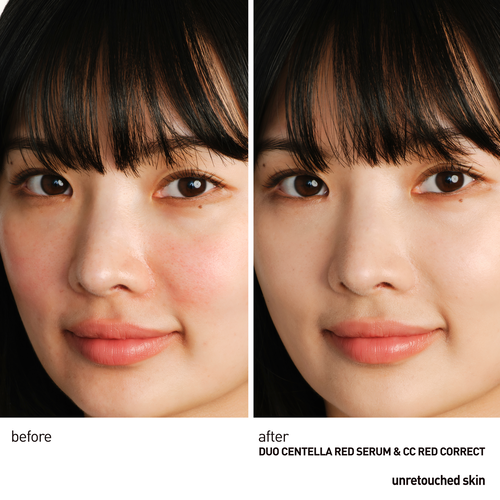 view 4/9 of Redness Duo, , large
